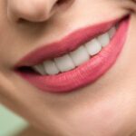 teeth whitening