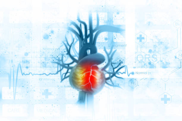 takotsubo cardiomyopathy