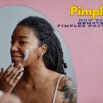 Remove Pimples Naturally