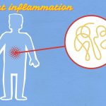 All about inflammation