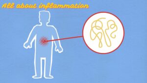 All about inflammation